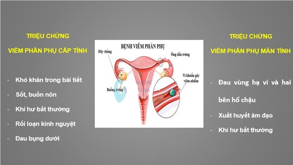 canh-bao-nguy-co-vo-sinh-o-nu-gioi-khi-mac-viem-phan-phu-man-tinh